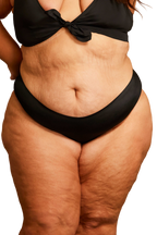 Woodmont Cheeky Bikini Bottom | FINAL SALE